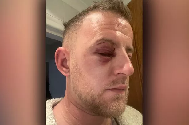 Brutal Attack in Bury Town Centre: Mac Goldworthy &amp; Daniel Flanagan